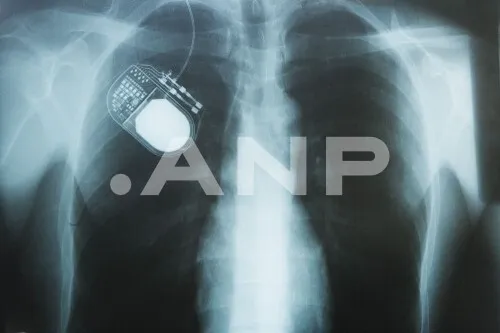 How a Delft Semiconductor Could Cure Diseases