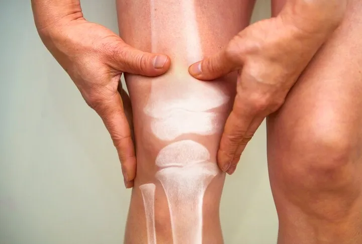 Do you need extra manganese for stronger cartilage? | Common Sense